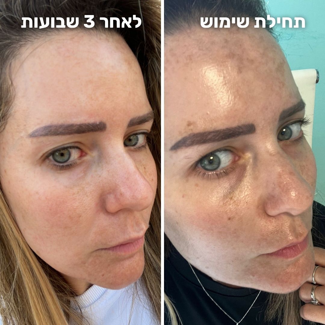 ⁦קרם לילה אקטיבי רטינול⁩ – תמונה ⁦3⁩